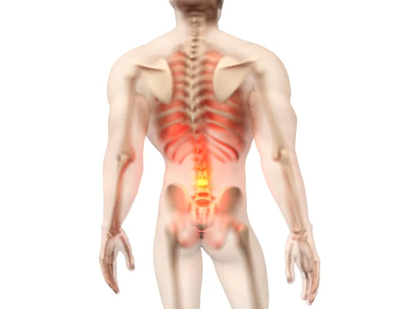 Mannelijke anatomie - pijn in de onderrug — Stockfoto